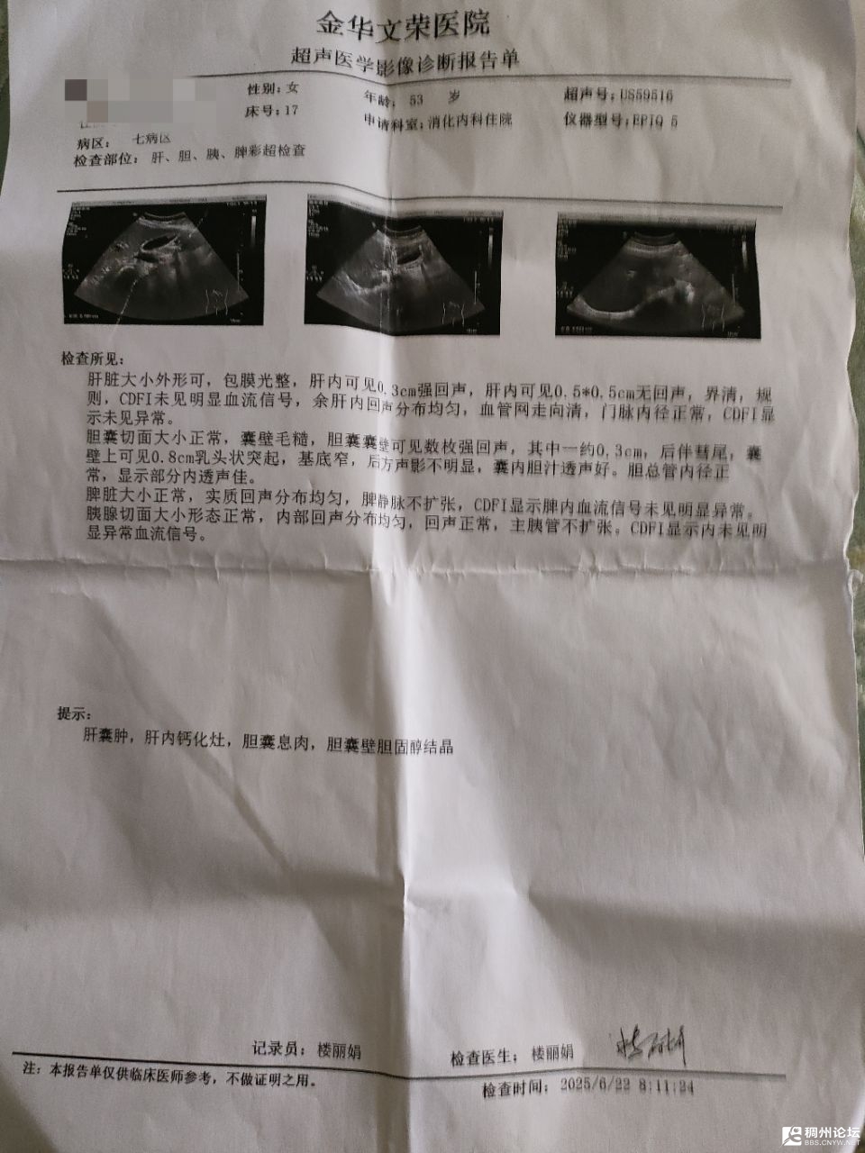 20250724174850front2_0_1066919_Ft2-HoMEiYRJstdKusAfWUhsAGU2.jpg